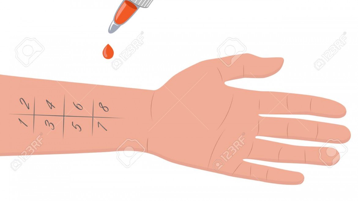 Allergy Testing